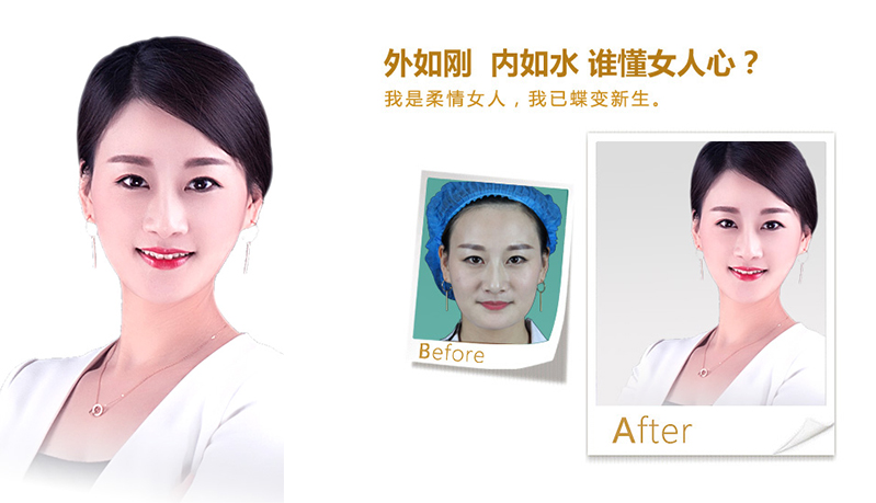 梅州V脸、线雕隆鼻